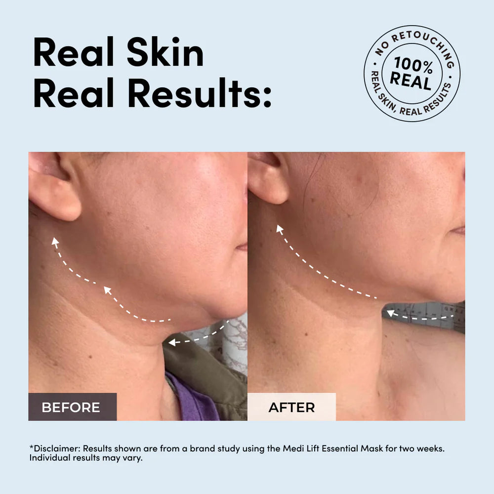 YA-MAN EMS Face Sculpting Essential Mask