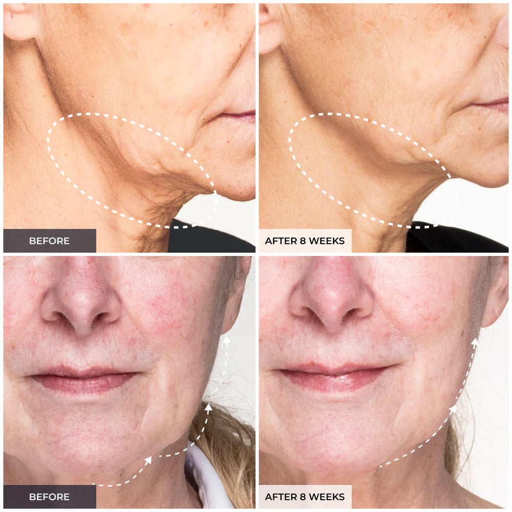 YA-MAN EMS Face Sculpting Essential Mask