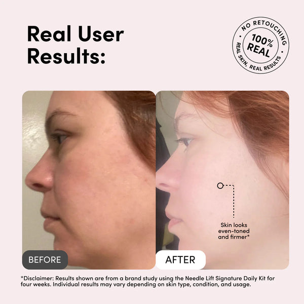 YA-MAN Needle Lift Signature Cream