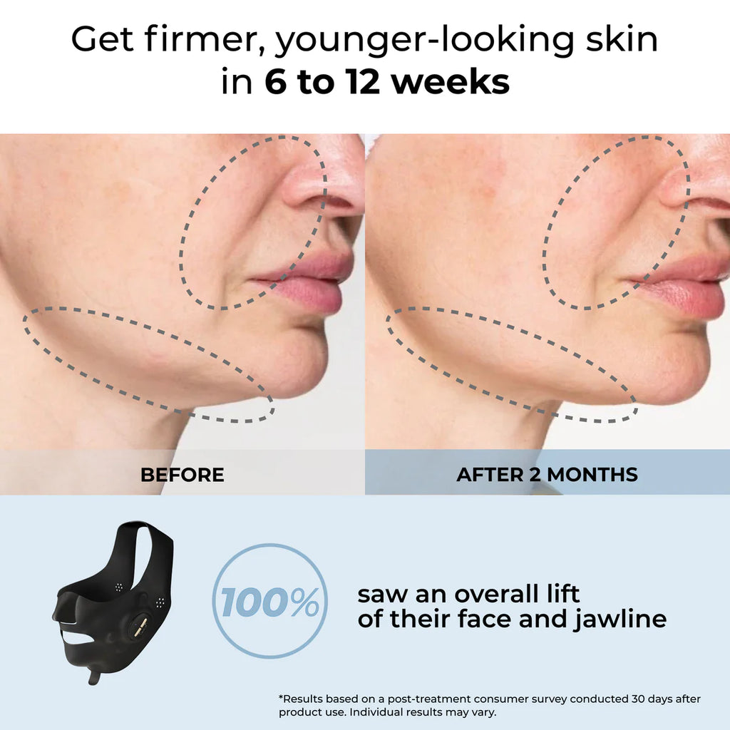 YA-MAN EMS Face Sculpting Essential Mask