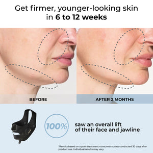 YA-MAN Medi Lift Essential Mask