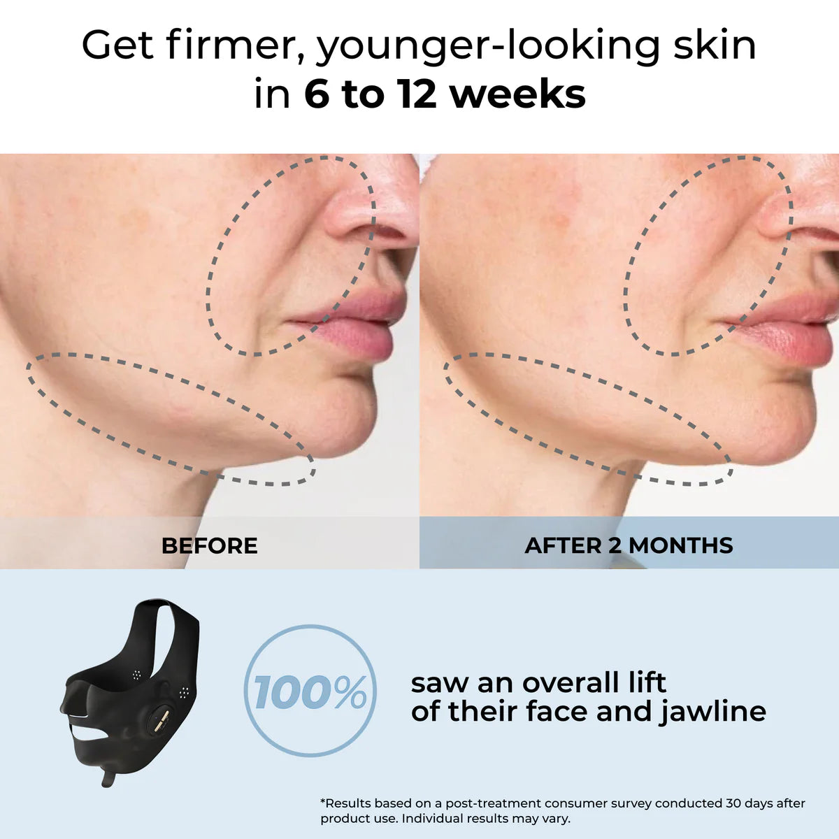 YA-MAN EMS Face Sculpting Essential Mask